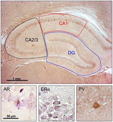 The Impact of Hippocampal Sex Hormones Receptors in Modulation of Depressive-Like Behavior Following Chronic Anabolic Androgenic Steroids and Exercise Protocols in Rats